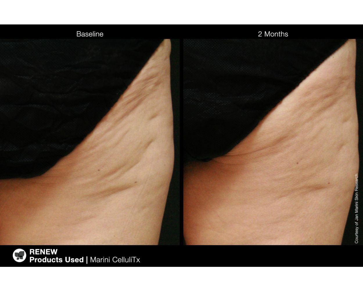 Jan Marini CelluliTx Cellulite Cream - Image 6