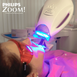 Philips Zoom Whitening Treatment