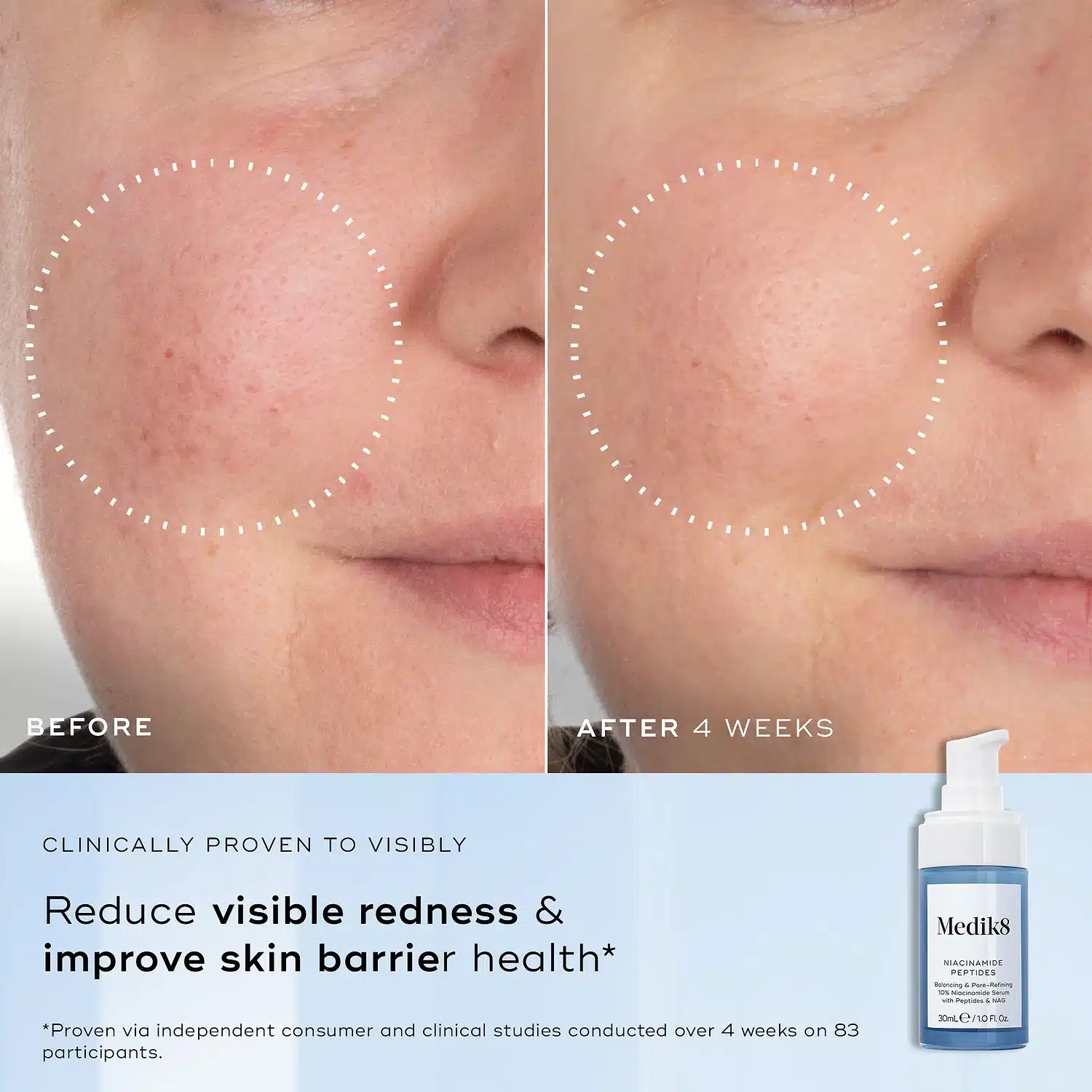 Medik8 Niacinamide Peptides 30ml - Image 3
