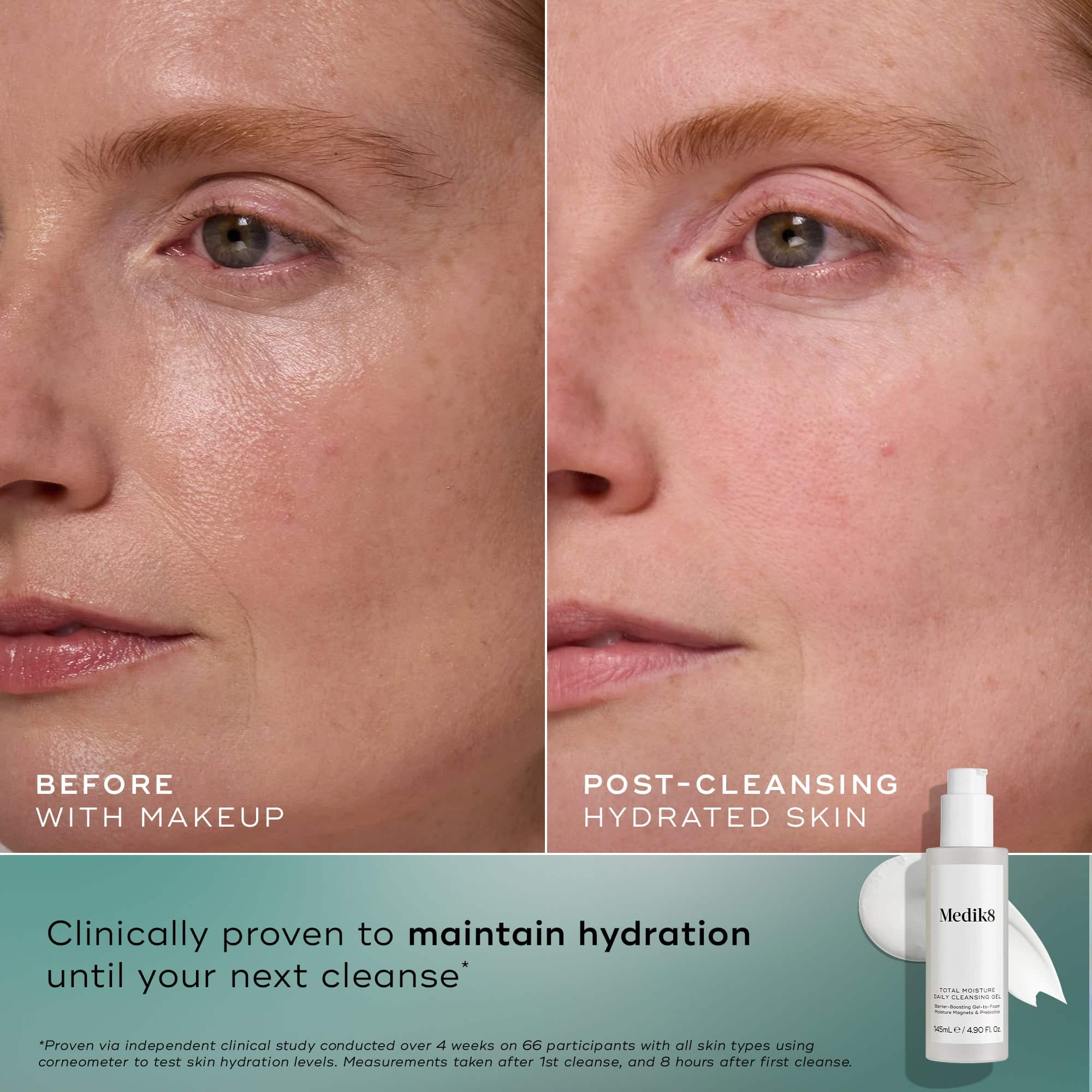 Medik8 Total Moisture Daily Cleansing Gel 145ml - Image 6