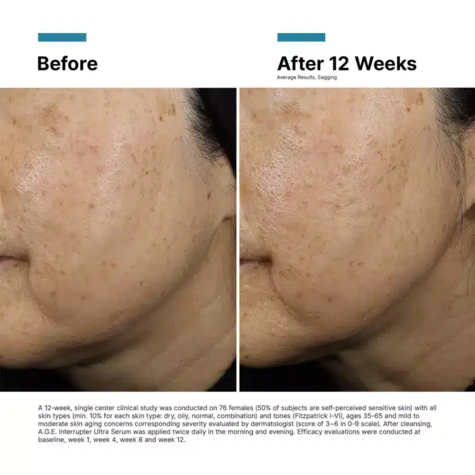 SkinCeuticals A.G.E. Interrupter Ultra Serum 30ml - Image 3